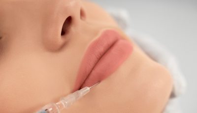 procedimento-de-aumento-labial-em-salao-profissional Preenchimento Labial